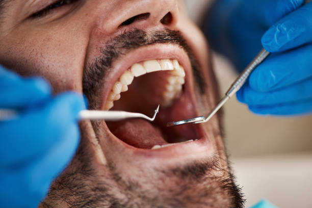 Best Tooth Infection Emergency Dentist  in Churubusco, IN